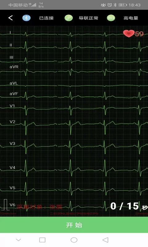 康乃心测心电官网正版下载
